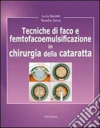 Tecniche di faco e femtofacoemulsificazione in chirurgia della cataratta libro