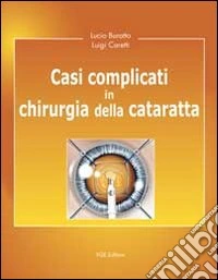 Casi complicati in chirurgia della cataratta libro