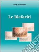 Le blefariti