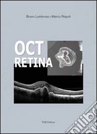 Oct retina