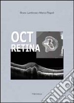 Oct retina