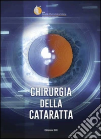 Chirurgia della cataratta. Relazione SOI 2015 libro