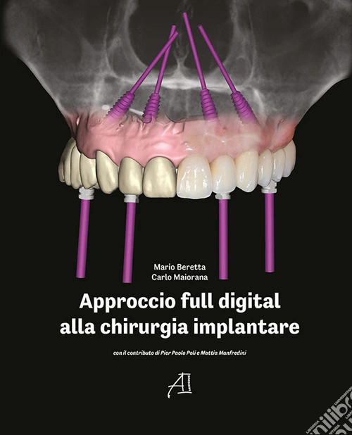 Approccio full digital alla chirurgia implantare