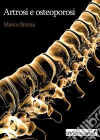 Artrosi e osteoporosi