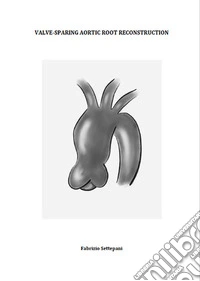 Valve-sparing aortic root reconstruction