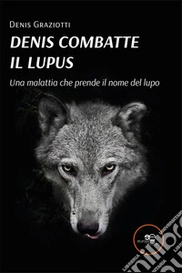 Denis combatte il lupus