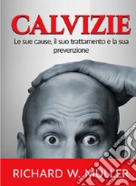 Calvizie. Le sue cause, il suo trattamento e la sua prevenzione libro