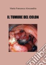 Il tumore del colon libro