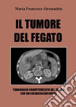 Il tumore del fegato libro