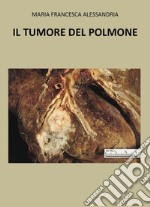 Il tumore nel polmone libro