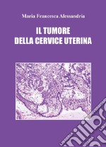 Il tumore della cervice uterina libro