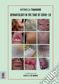 Dermatology in the time of Covid-19