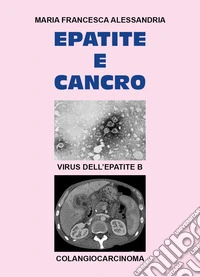 Epatite e cancro