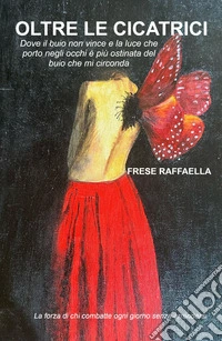 Oltre le cicatrici. Dove il buio non vince e la luce che porto negli occhi è più ostinata del buio che mi circonda libro