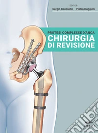 Protesi complesse d'anca. Chirurgia di revisione. Ediz. illustrata libro